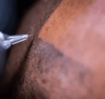 micropigmentación capilar