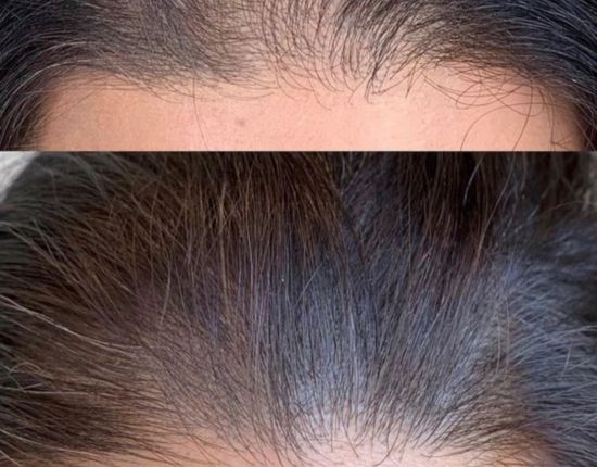 Redensificacion Mujeres